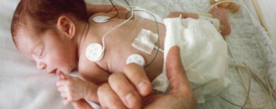 Un 6% de los nacidos en 2014 en el CHUF fueron prematuros