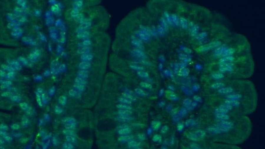 Analizan el genoma de fl ora intestinal para avanzar en la detección precoz del cáncer de colon