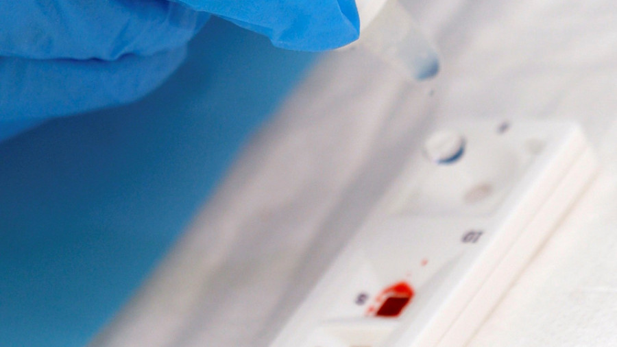 Bajan en más de 150 los positivos detectados en Galicia con 3.000 PCR menos