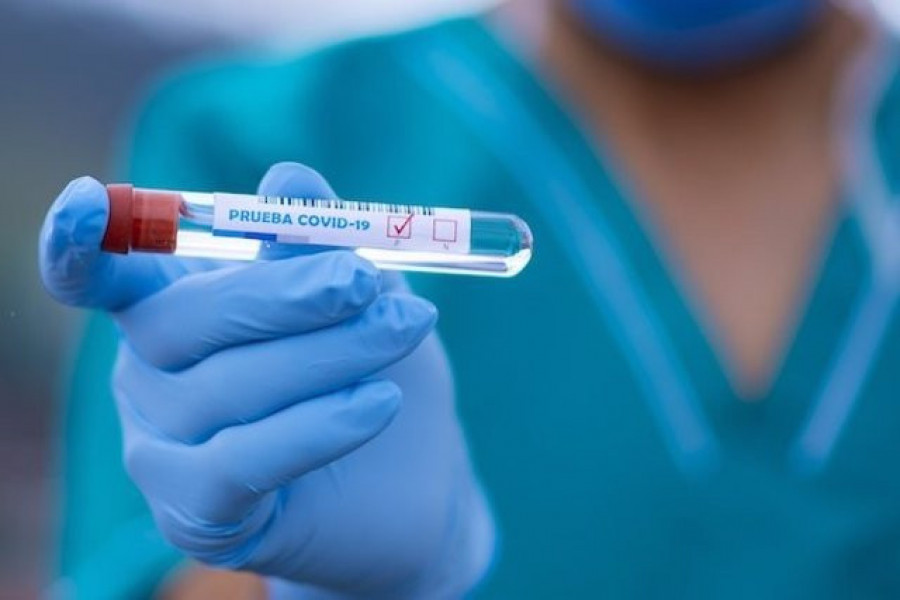 España ha realizado más de 33,2 millones de pruebas diagnósticas desde el inicio de la epidemia
