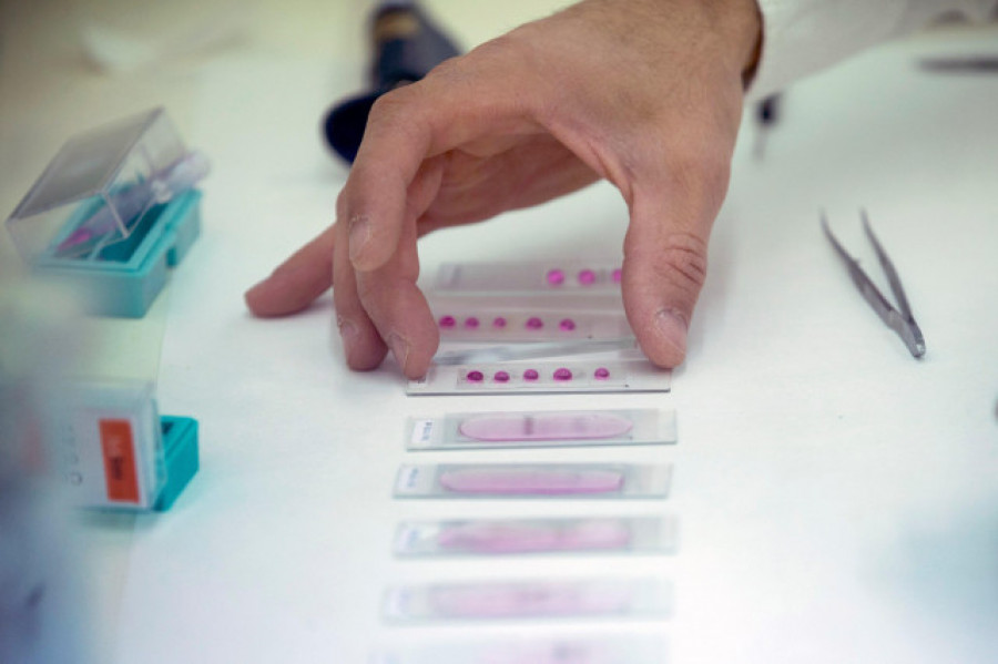 La alergia primaveral se prolongará hasta tres meses más en la Galicia costera