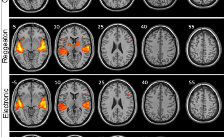 El cerebro lo tiene claro: Reguetón 1- Música clásica 0