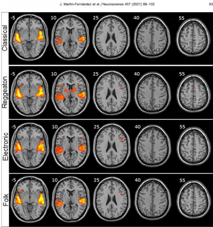 El cerebro lo tiene claro: Reguetón 1- Música clásica 0