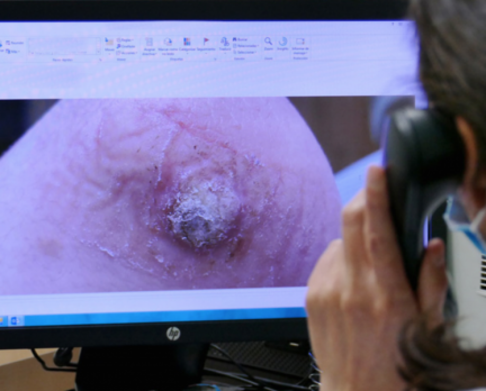 Teledermatología