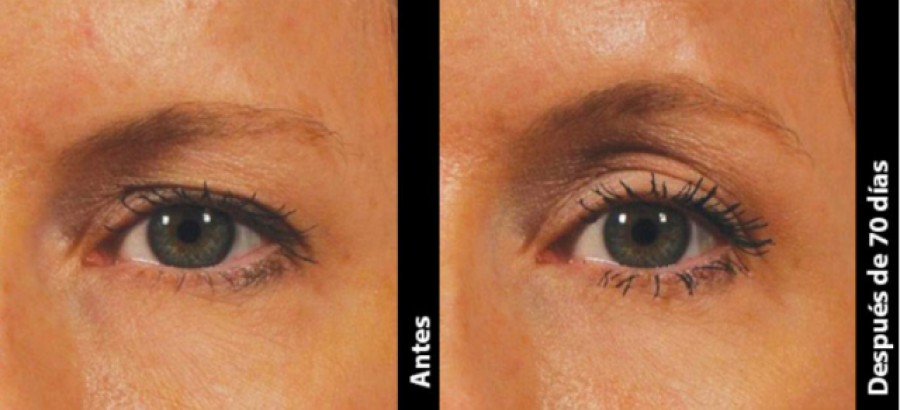 Luce una mirada atractiva gracias al centro médico estético Kerala
