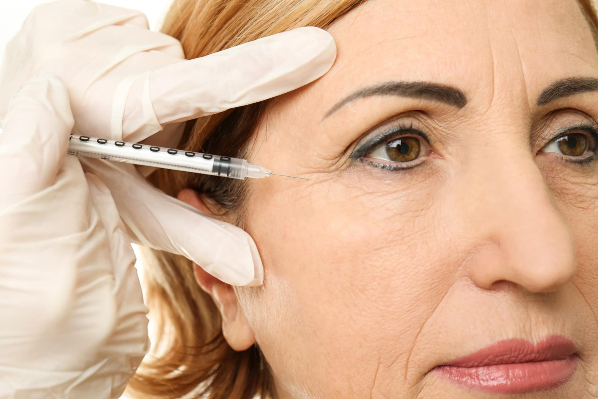 Eliminar arrugas botox